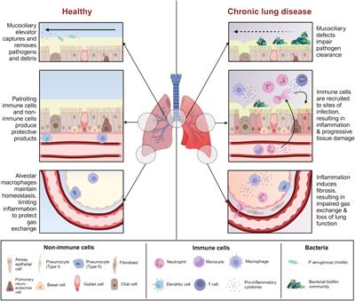 Pseudomonas aeruginosa in chronic lung disease: untangling the dysregulated host immune response